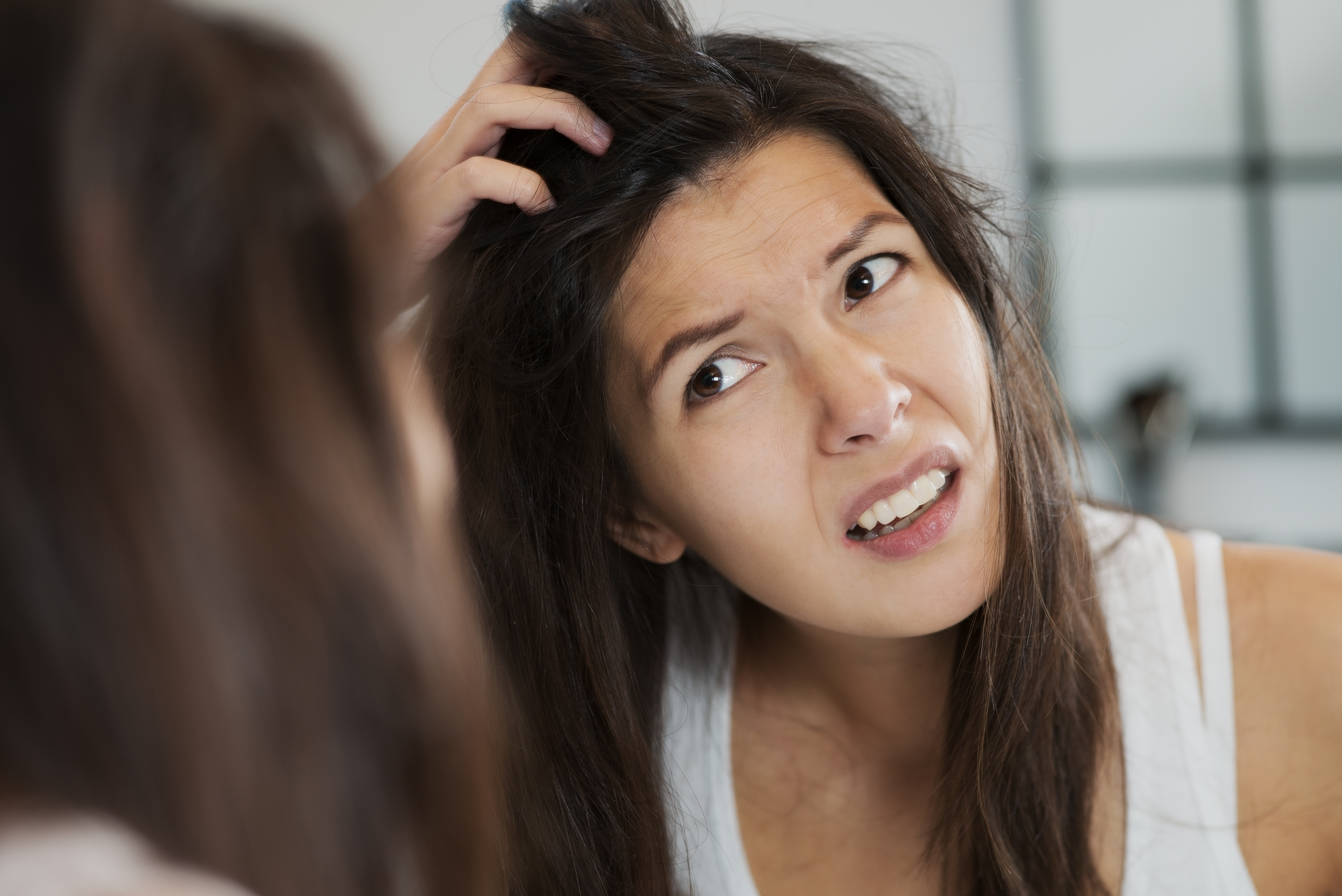 Scalp Psoriasis signs and symptoms
