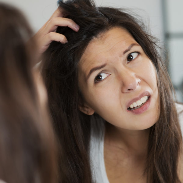 Scalp Psoriasis signs and symptoms